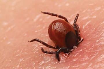 Tick Fever – Health Feature